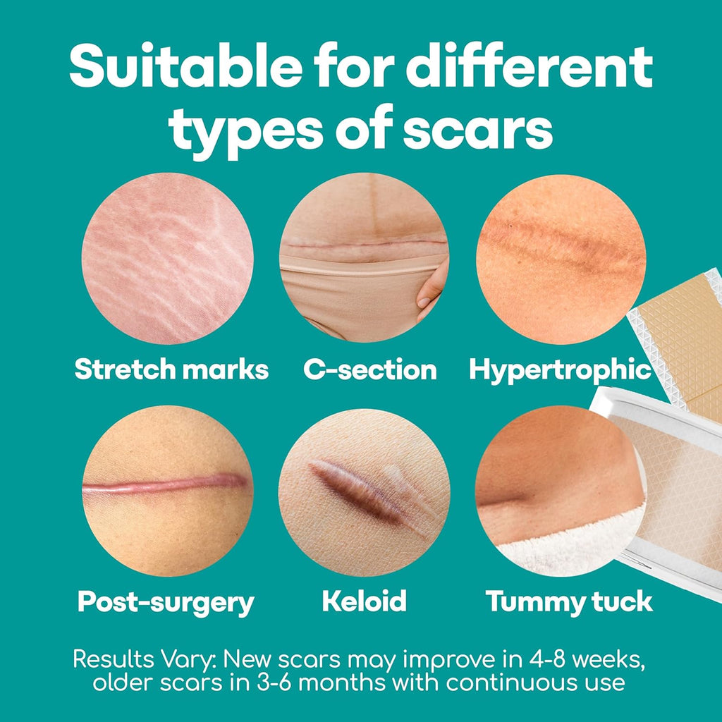 Silicone Scar Sheets, 80 Inches Long - Reusable Silicone Scar Tape - Includes Hygienic Storage Case G43103