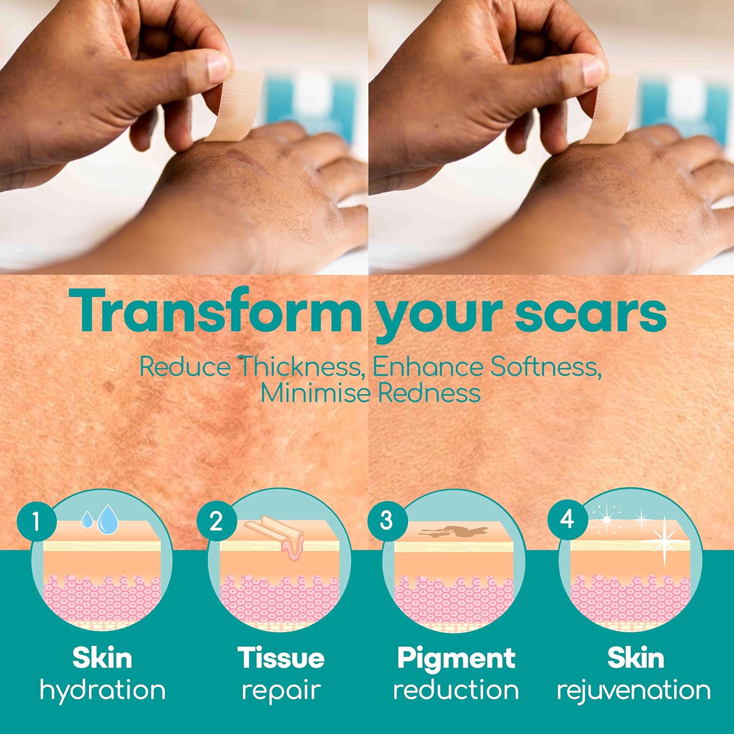 Silicone Scar Sheets, 80 Inches Long - Reusable Silicone Scar Tape - Includes Hygienic Storage Case G43103