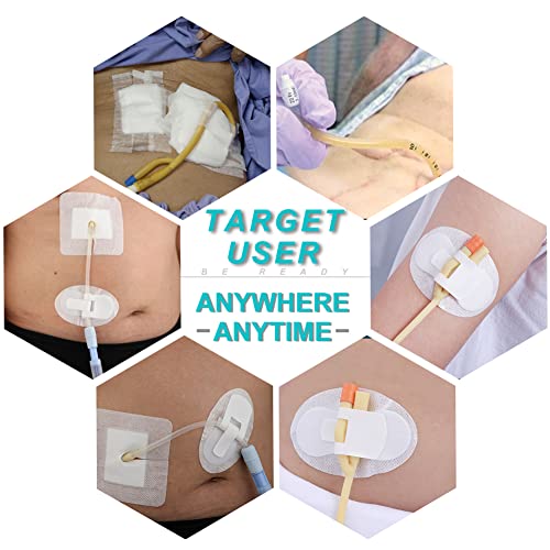 PD Catheter Holder Adhesive Patch Stabilization Device Non-Woven Dressing (Pack of 5) S7798