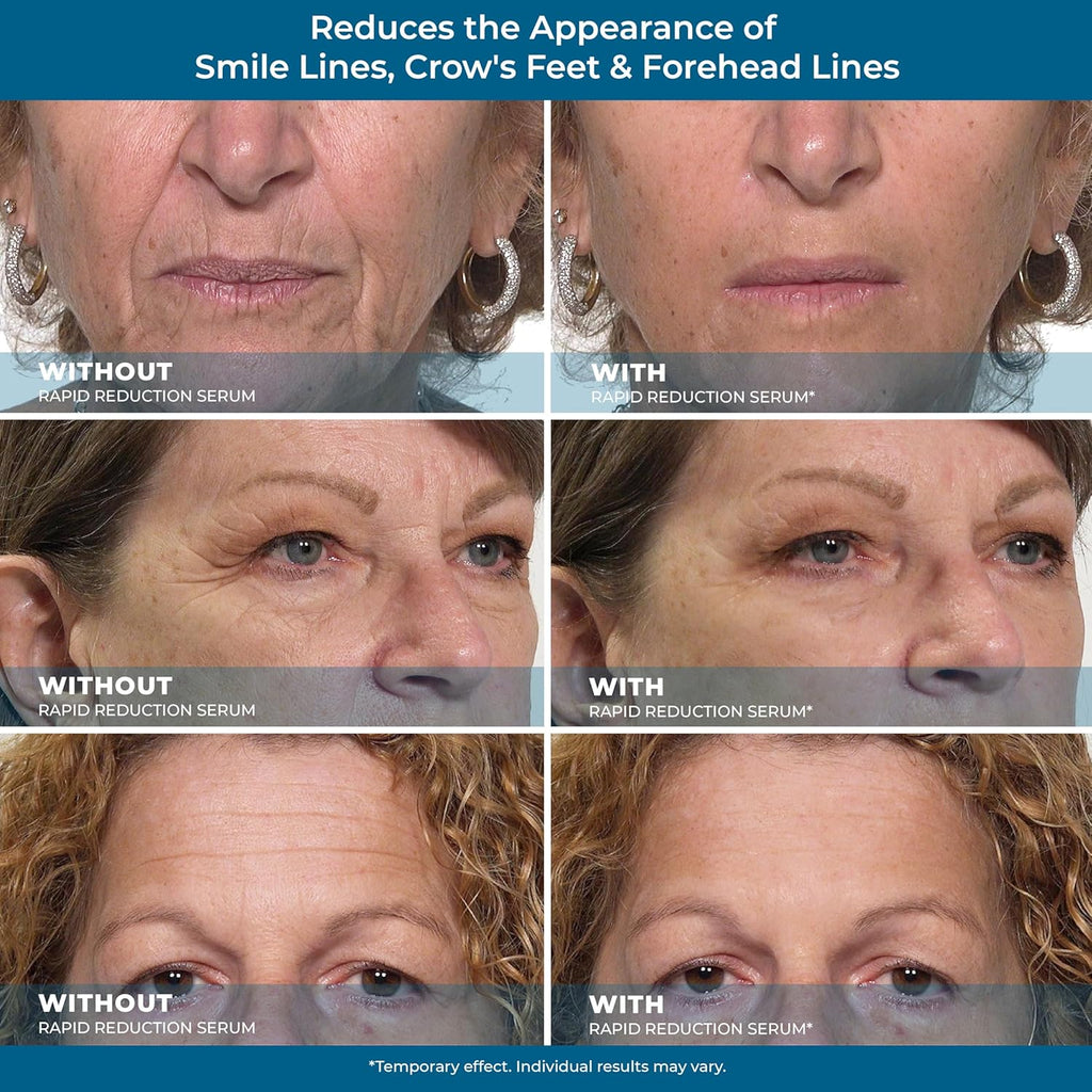 Rapid Reduction Eye Serum H3652