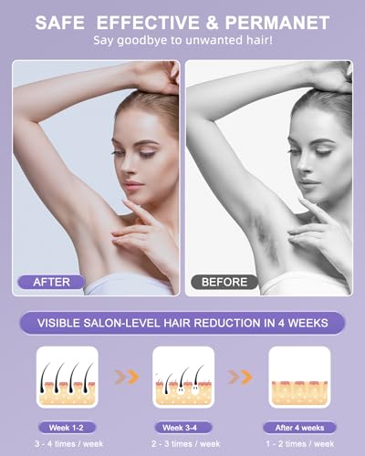 IPL Hair Removal Device with Cooling A5827